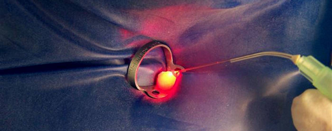 studio-dentistico-ballestrasse-besana-brianza-erogatore-endodonzia