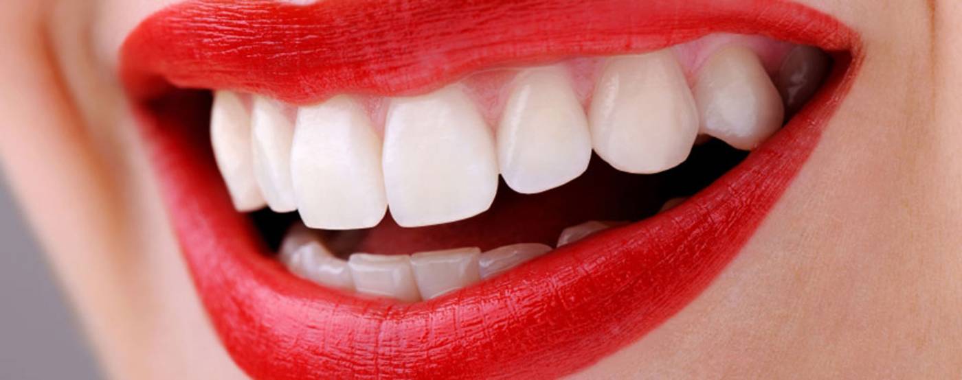 studio-dentistico-ballestrasse-besana-brianza-faccette