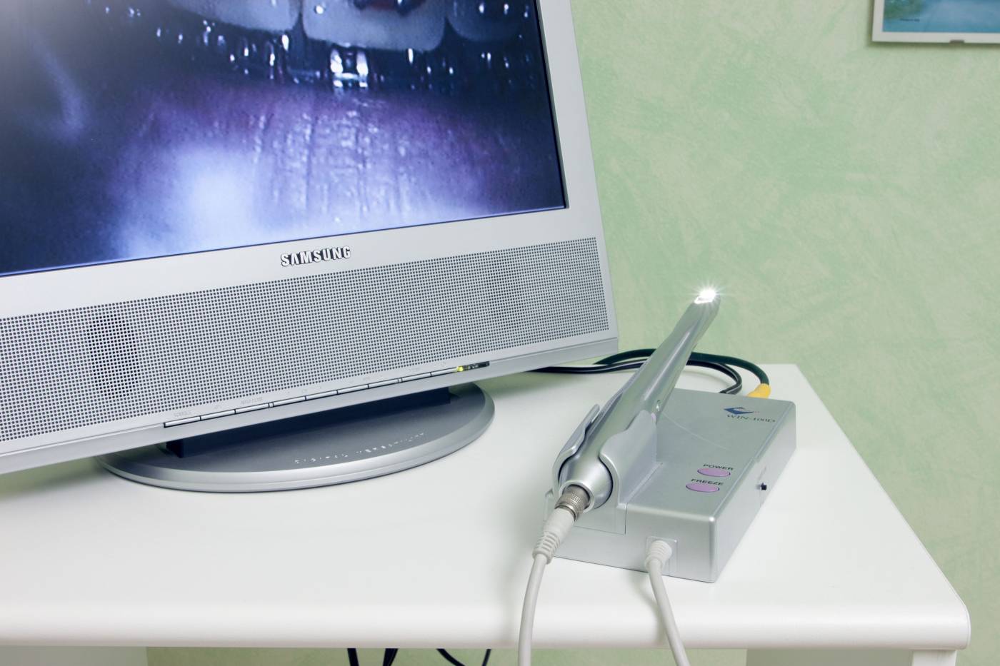 studio-dentistico-ballestrasse-besana-brianza-telecamera-intraorale (2)