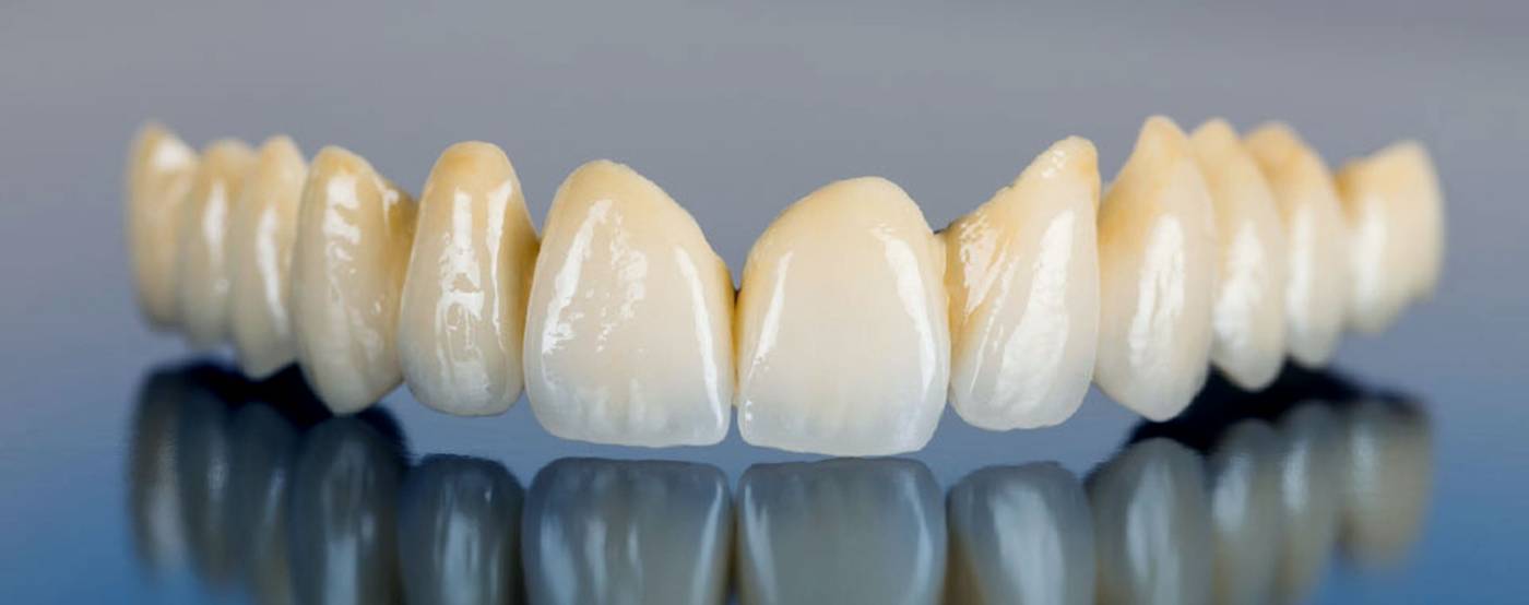 studio-dentistico-ballestrasse-besana-brianza-corone-metal-free