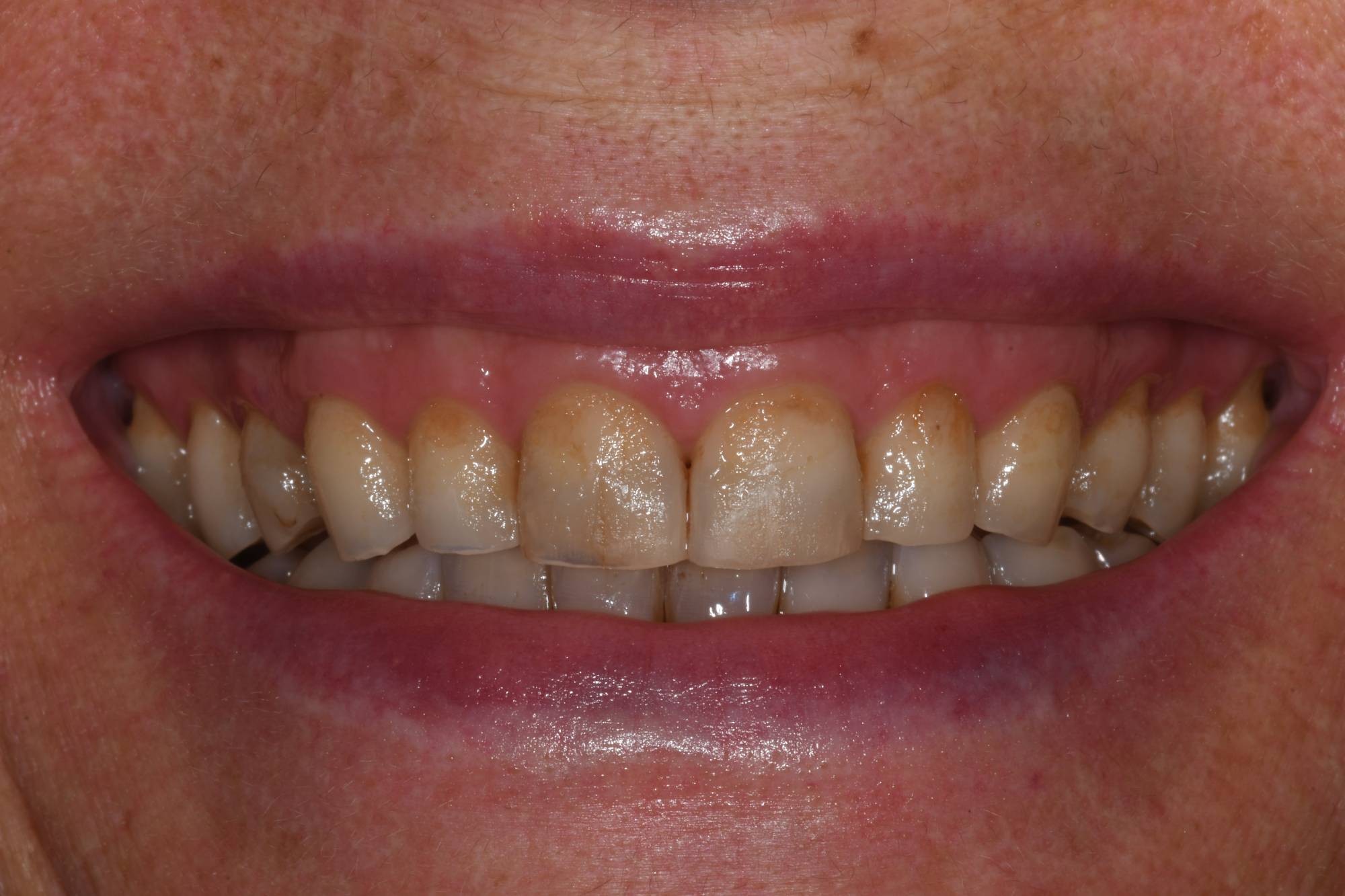 DSC_0382-min