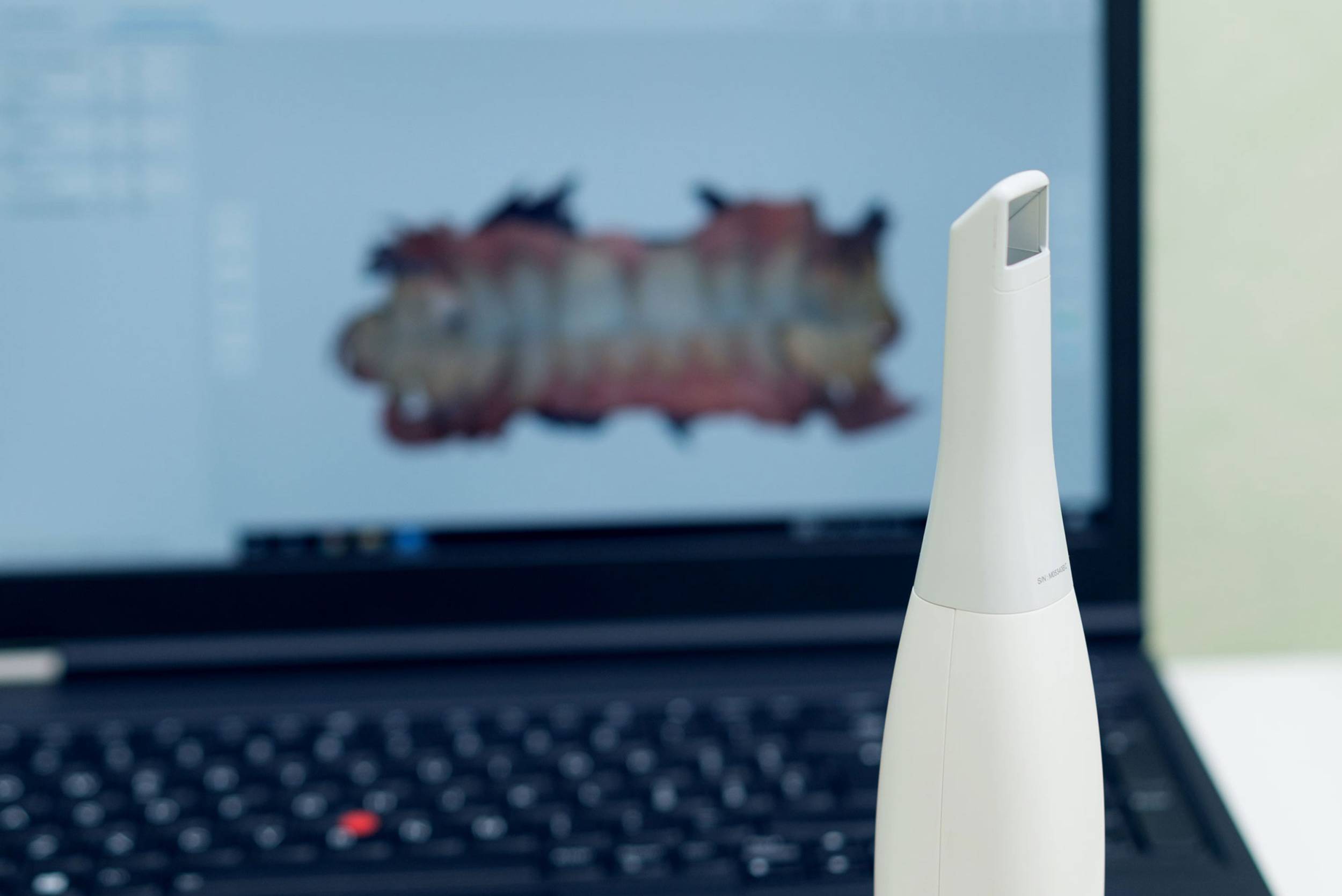 studio-dentistico-ballestrasse-besana-brianza-scanner-intraorale-4