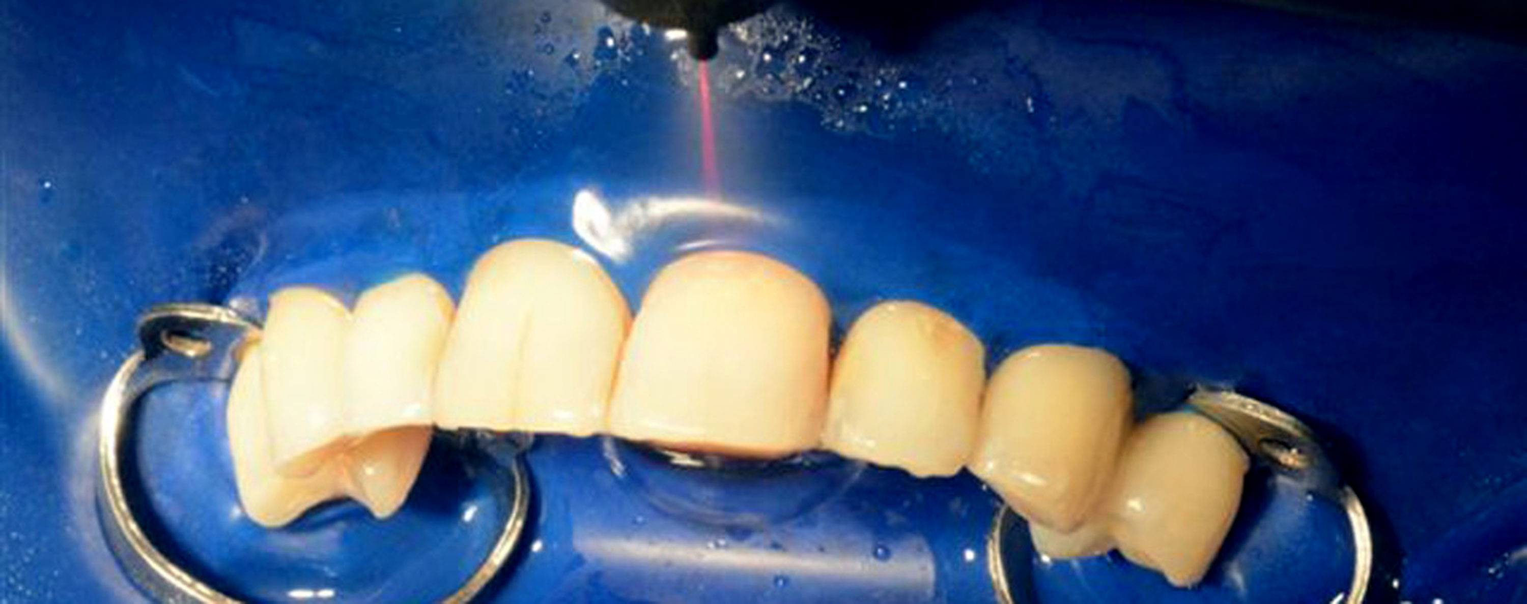 studio-dentistico-ballestrasse-besana-brianza-conservativa