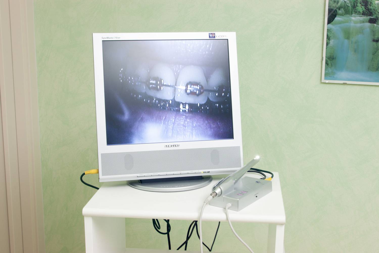 studio-dentistico-ballestrasse-besana-brianza-telecamera-intraorale