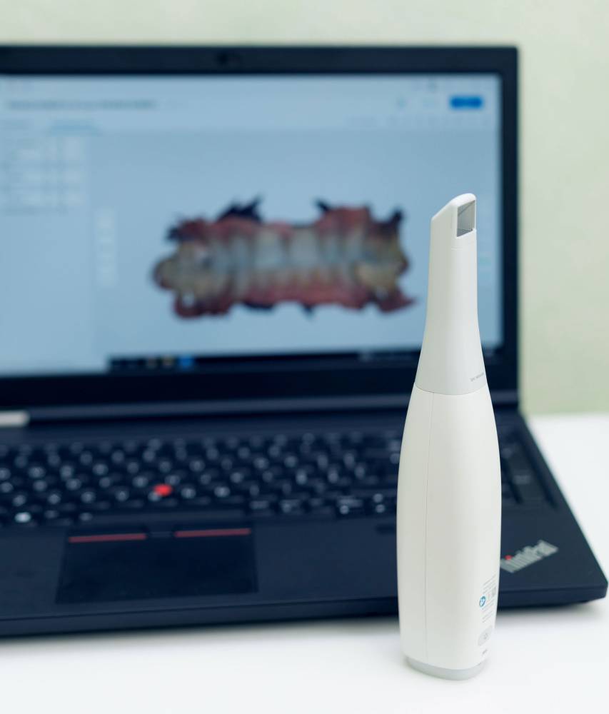 studio-dentistico-ballestrasse-besana-brianza-scanner-intraorale-5